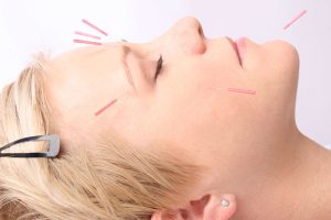 http://www.sedum-zentrum.de/wp-content/uploads/Akupunktur-300x200.jpg
